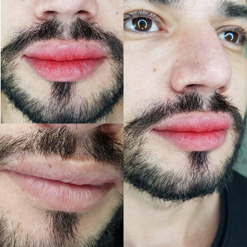 revitalização labial